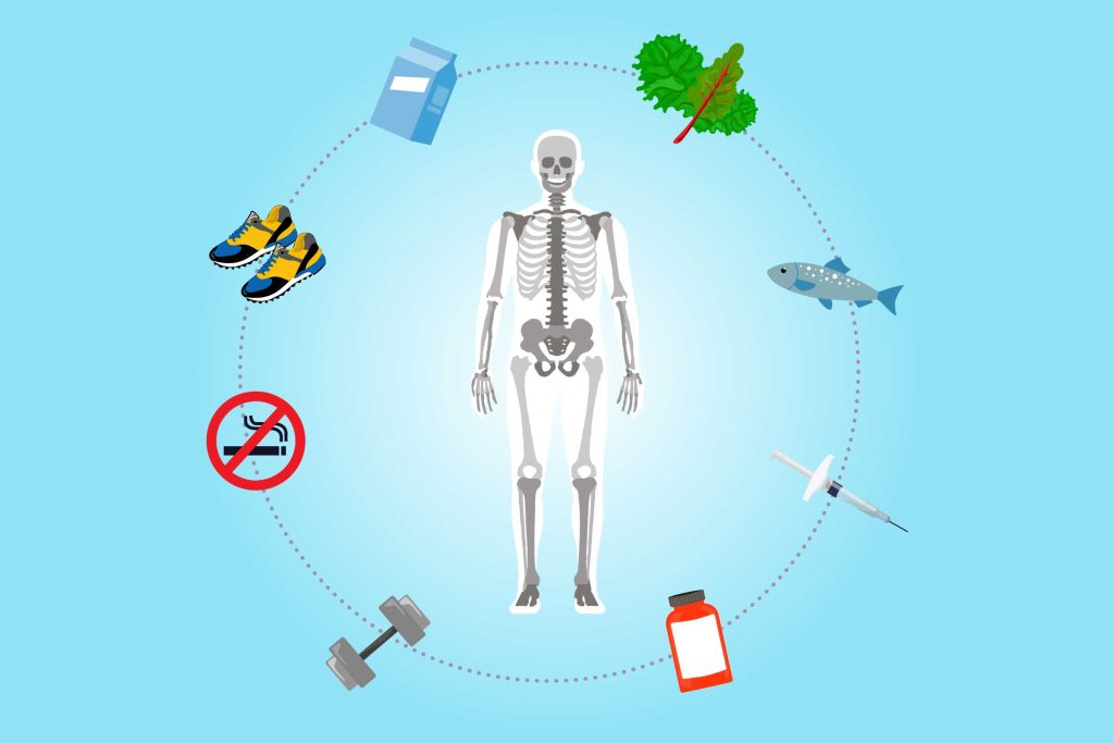 How To Treat Osteoporosis Naturally And Strengthen Your Bones